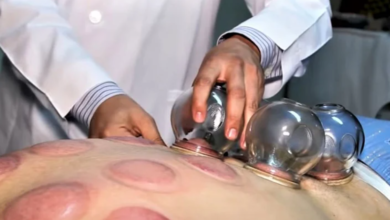 تاريخ الحجامة عبر الحضارات القديمة تاريخ الحجامة عبر الحضارات القديمة